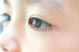 視力 新生児 【体験談あり】赤ちゃんの斜視の種類、見分け方、原因、治療法を紹介！検査内容は？手術は必要？